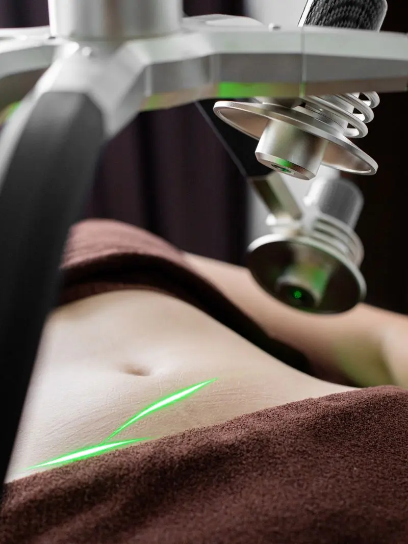 Body contouring non invasif chez Casa Aesthetic